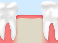歯が抜けるのは「老化現象」ではありません